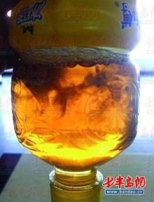 我的眼睛靠鼻子侧在白眼珠上有絮状物