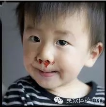 【要知道】八大表现,警惕肝功能异常!