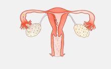 尴尬的问题:阴吹是怎么回事?