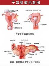 上海<em>女性常规</em>妇科<em>检查有哪些</em>项目?【15】-新闻