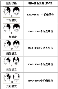 植发靠谱吗?安全性如何