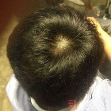 <em>头发</em>是不是<em>越粗</em>越好【2】-新闻频道-手机搜狐