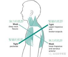 这个姿势会使上斜角肌与胸肌(粗线处)变紧,下斜角肌与深层颈部屈肌