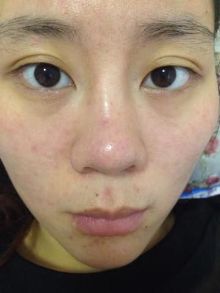 女性必知!多喝水真能对皮肤好吗?