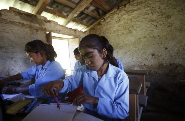 尼泊尔狼人综合症母子通过激光褪毛重新融入社