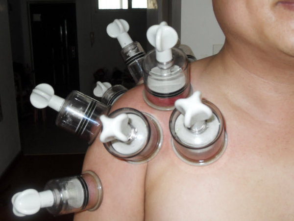 在家治疗肩周炎,一分钟就学会-资格考试-电气工程师考试网