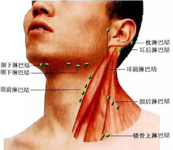 1,颌下淋巴结肿大 多与口腔,面颊部炎症相关,在鼻,咽,扁桃体等上呼吸