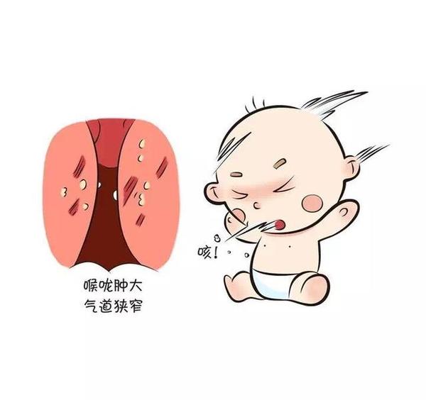又是鼻涕又是咳嗽还呼哧呼哧大喘气,宝宝这是怎么
