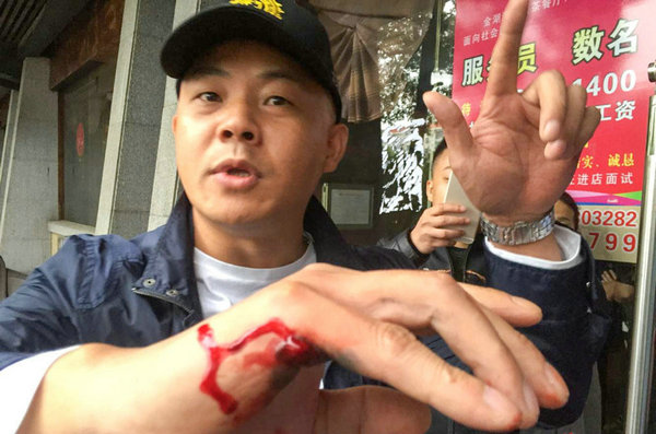 上海退伍兵徒手夺枪救人:手被打穿仍撂倒歹徒