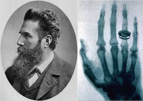 1901年,发明x射线的德国科学家伦琴收到瑞典的一封来信,请他前往斯德