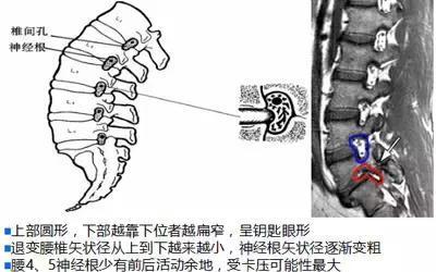 经椎间孔脊柱内镜技术