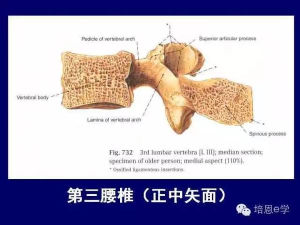 在腰椎侧位x线像上,根据椎上切迹矢径的大小,可大致估计侧隐窝的宽窄