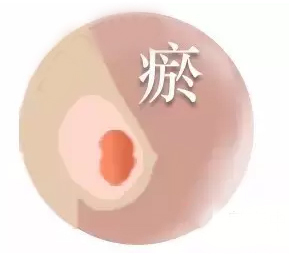 上海乳腺科排名_上海乳腺专家排名(2)