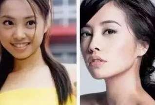 幸好郑爽假体取得早,韩君婷鼻子只剩鼻梁?杨紫脸
