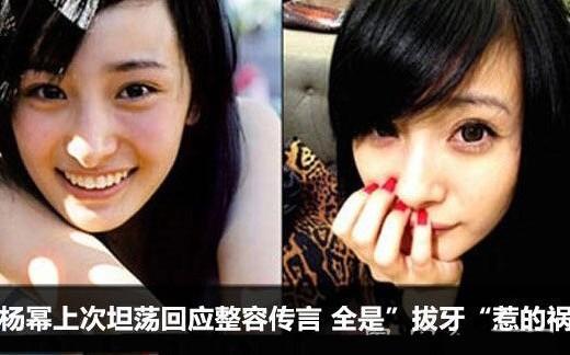 杨幂为了变美蜂蜜瘦身?郭德纲一句话道出了实情加瘦脸拔牙怎样醋图片