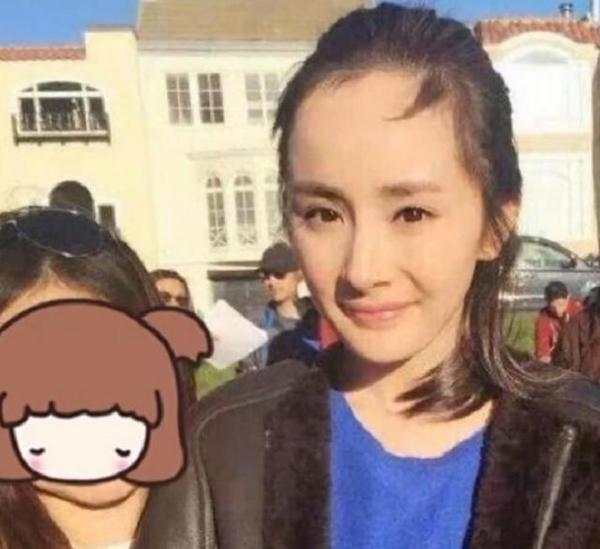 杨幂为何不像古天乐发际线m型,如何应对?
