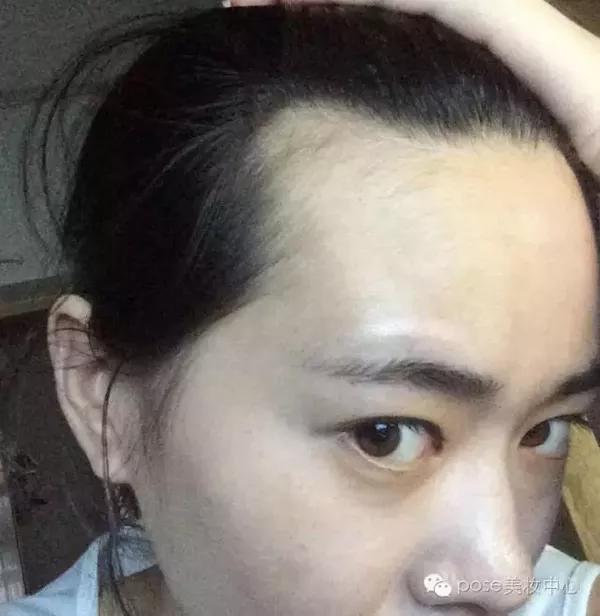 发际线漂亮就可以无所顾忌地露额头,但如果发际线不好看,只能用刘海