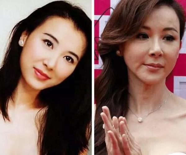 女明星美容针打过量!还能补救吗?