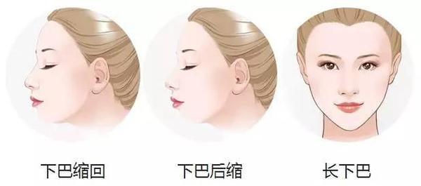 啥下巴兜财又好看?