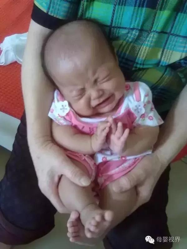 这么小的孩子怎么会有脱肛呢?