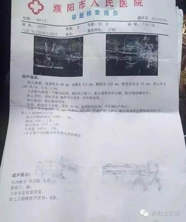 a6xldf9566440927855.jpg