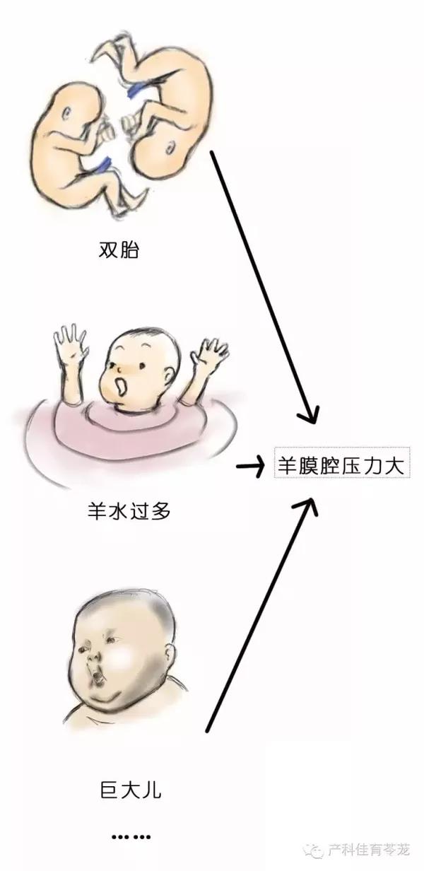 肚子没疼,先发生胎膜破裂,专业术语为"胎膜早破".