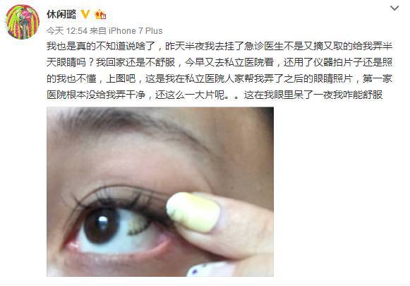 隐形眼睛度数怎么算,隐形眼睛度数怎么算的