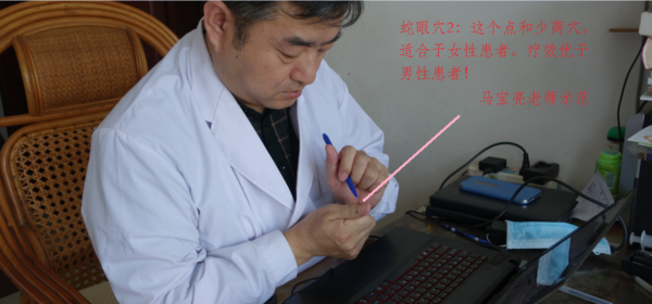 治疗带状疱疹的绝招秘术!
