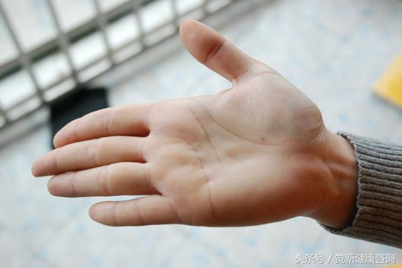 做什么运动对腰肌劳损有好处 a2mdfe88957618102596.jpg