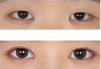 客厅要不要做双眼皮 a8kuku4920950325404.jpg