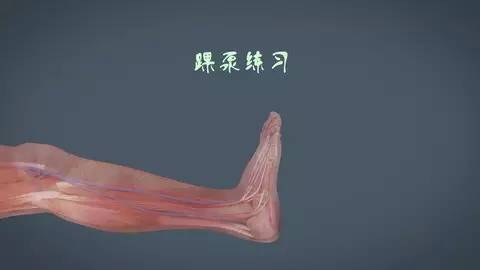 预防下肢静脉血栓的操 a4x56h5038680146091.jpeg