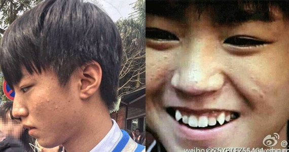 王俊凯校园生活曝光,素颜长痘,皮肤暗沉没光彩!
