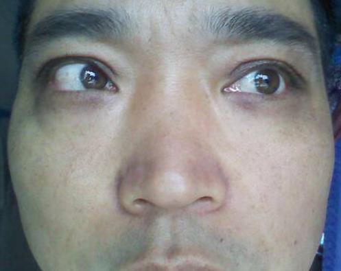 你的眼白有发黄么?有的话赶紧治,特别是第3点