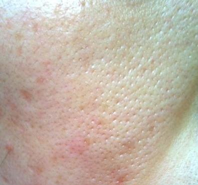 闭口是什么啊 a1xvar352856092459.jpg