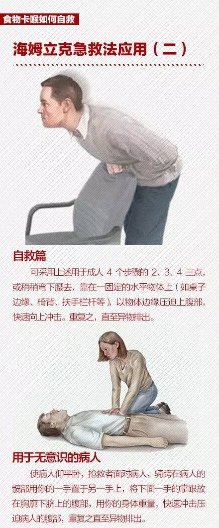 "海姆立克急救法"教你怎么急救!