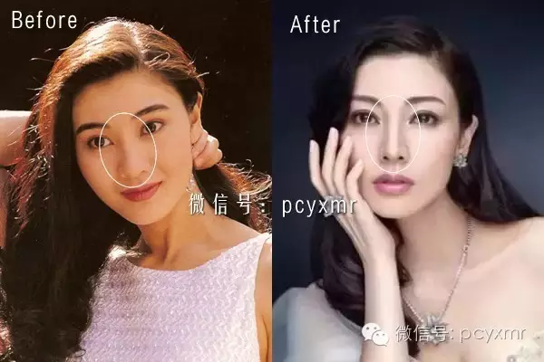 李嘉欣钟楚红都是大鼻子美女