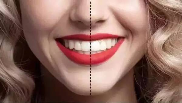 90%人都毁在牙齿上其实这样做牙齿可以马上变美的
