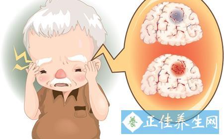 什么病引起脑梗塞 a0hy9j6905841689227.jpg