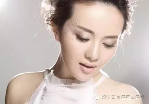 痘印最久要多久消失 脸上痘印如何去除?不要相