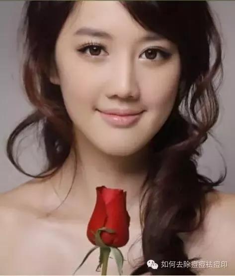 痘印最久要多久消失 脸上痘印如何去除?不要相