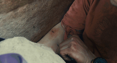 他为了救自己用小刀生生切下了自己的手臂 !