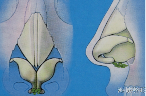 凸嘴怎么画 a77ldv5325654732708.png