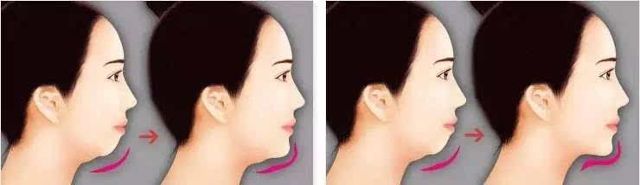 56.8%的重庆美女脸型不够完美源于下巴