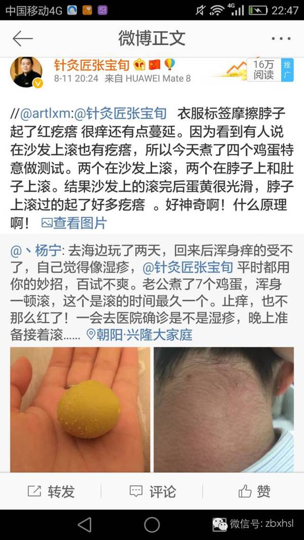 张宝旬:关于滚鸡蛋治湿疹的事,且看网友们发来的亲身体验