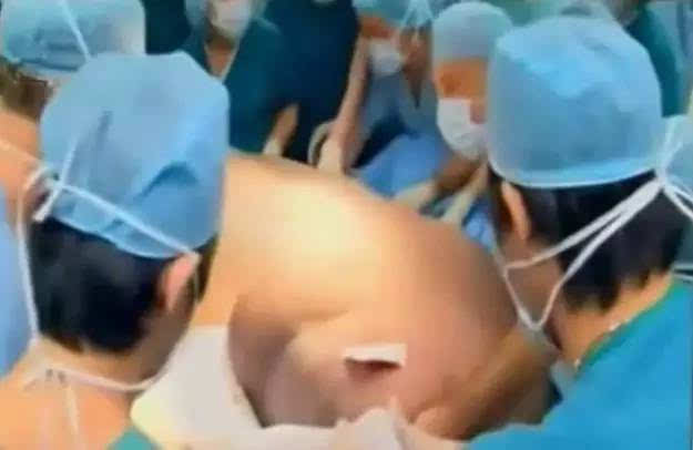 10多个医生接生,肚子都要撑破了!
