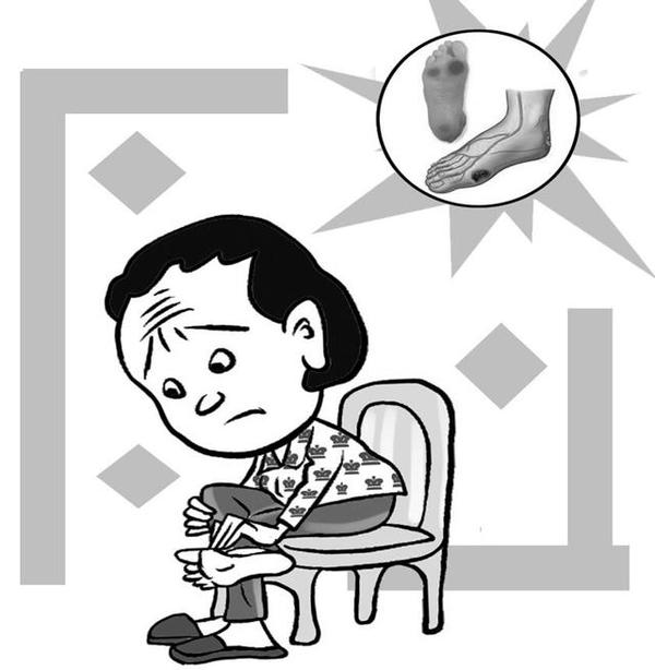 糖尿病患者病足早期很难被发现!