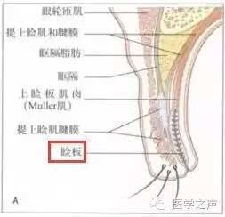 长针眼用针点七下是什么原理_长针眼是什么样子照片(2)