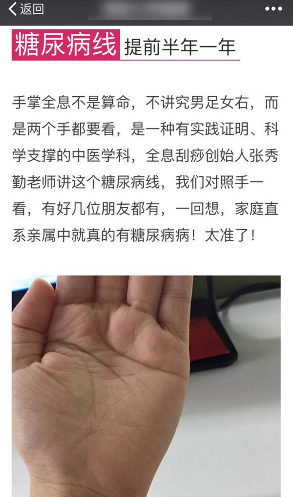 真的!看掌纹可预测糖尿病?不