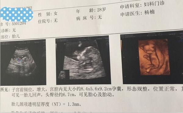 怎样才知道是不是输卵管堵塞 a7ocd660802536032596.jpg