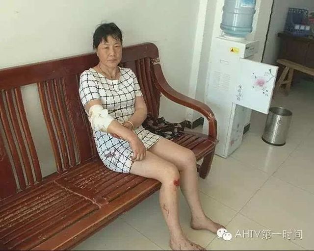 他却恨妻子 庐江这对夫妻一言不合动菜刀!